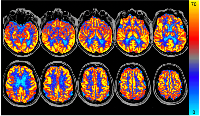 %learn about nutrition mental health %The Center for Nutritional Psychology