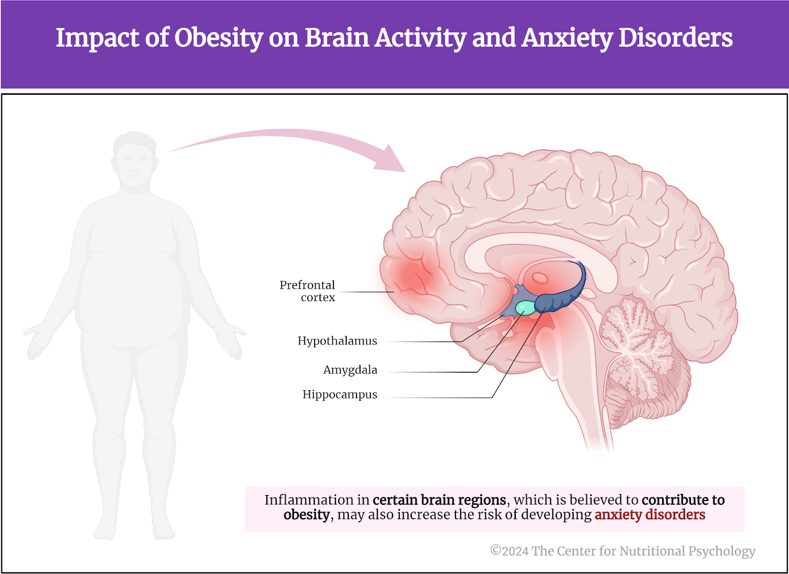 %learn about nutrition mental health %The Center for Nutritional Psychology
